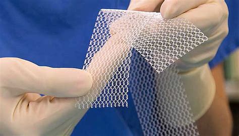 Controversial Pelvic Mesh Implants Banned In Australia Free Malaysia