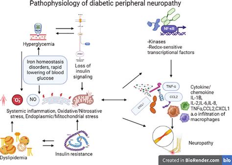 Pathophysiology Of Diabetic Neuropathy Multiple Pathways Hexosamine