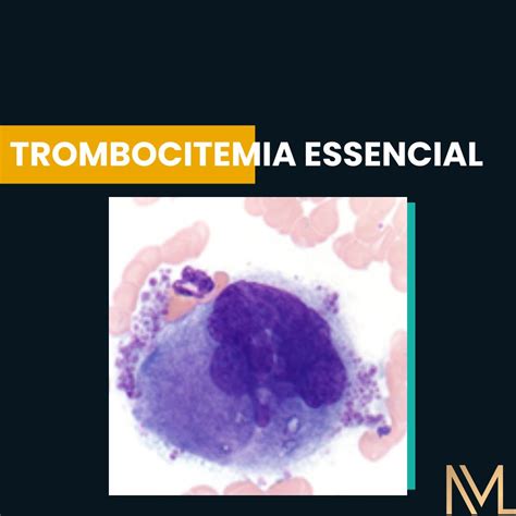 Trombocitemia essencial Aspectos Clínicos INML