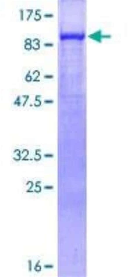 Novus Biologicals Recombinant Human Gamma Catenin GST N Term Protein