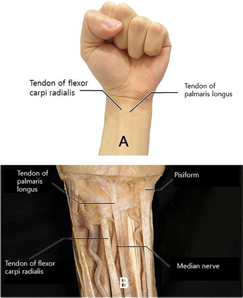 Wrist Surface Anatomy