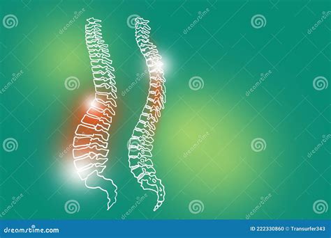 Afbeelding Van De Menselijke Wervelkolom Op Lichtgroene Achtergrond
