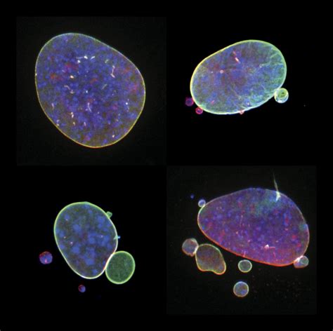 Micronuclei And Nuclear Blebs IMAGE EurekAlert Science News Releases