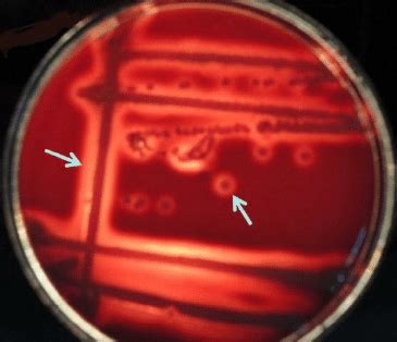 β hemolysis on 5 sheep blood agar by S aureus Formation of β