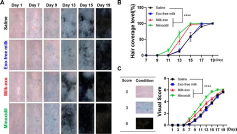 Frontiers Potential Of Colostrum Derived Exosomes For Promoting Hair