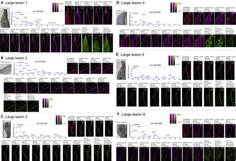 Identification And Visualization Of Oxidized Lipids In Atherosclerotic