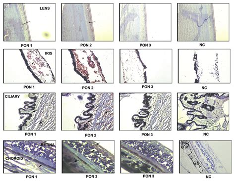 tissue distribution  paraoxonase     immunolocalization