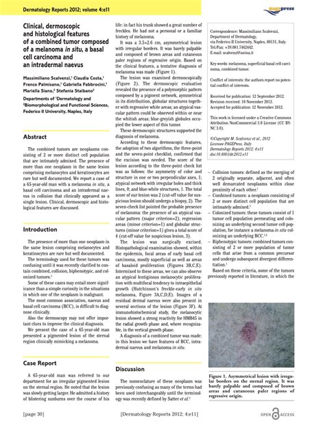 Pdf Clinical Dermoscopic And Histological Features Of A Combined