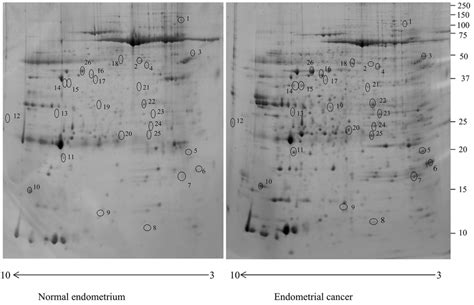 Two Dimensional Electrophoresis Map Of The Normal Endometrium Uterine