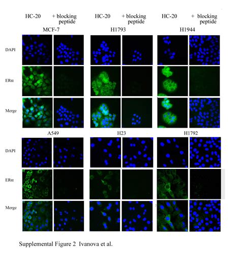 Sex Differences In Estrogen Receptor Subcellular Location And Activity