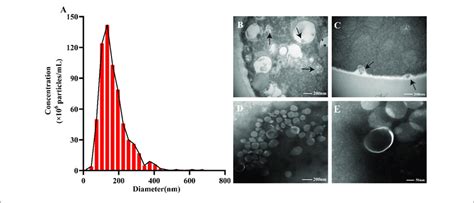 The Size Distribution And Morphology Of Extracellular Vesicles Evs