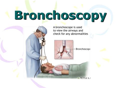 Bronchoscopy, Diagnostic technique