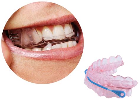 Mandibular Advancement Splints MAS Cardio Respiratory Sleep Australia