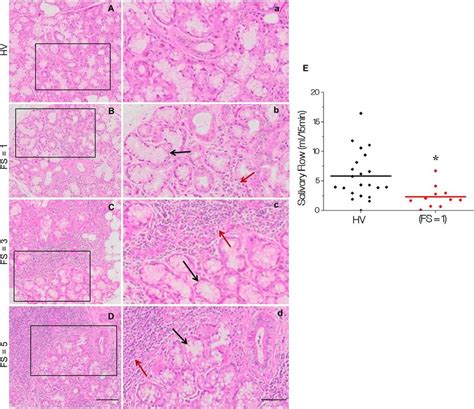 Morphology Of Minor Salivary Glands From Healthy Volunteers Hv And