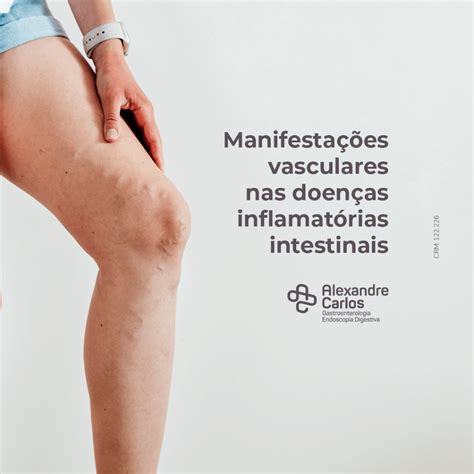 Manifestações Vasculares Nas Doenças Inflamatórias Intestinais Diis