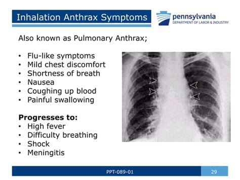 Infectious Diseases Pptx