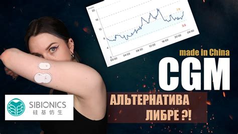 SIBIONICS ДЕШЁВЫЕ СЕНСОРЫ ДЛЯ ПОСТОЯННОГО МОНИТОРИНГА САХАРА | ЧТО ЭТО ...