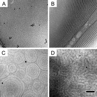 Energy Filtered Transmission Electron Microscopy Eftem Analysis