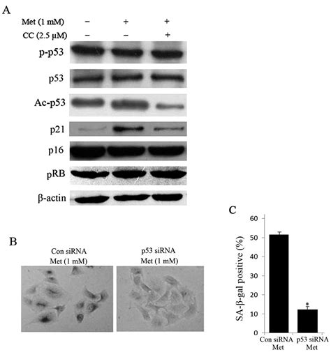 Low Concentration Of Metformin Induces A P53 Dependent Senescence In