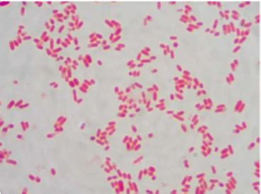 Staphylococcus Epidermidis Endospore Stain