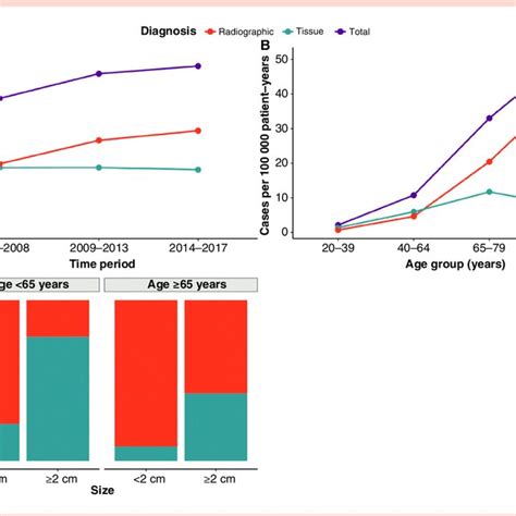 Simpson Grading System For Extent Of Resection Of Meningiomas Adopted