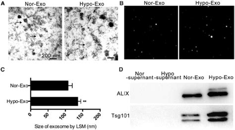 Characterization Of Nor Exo And Hypo Exo A Transmission Electron