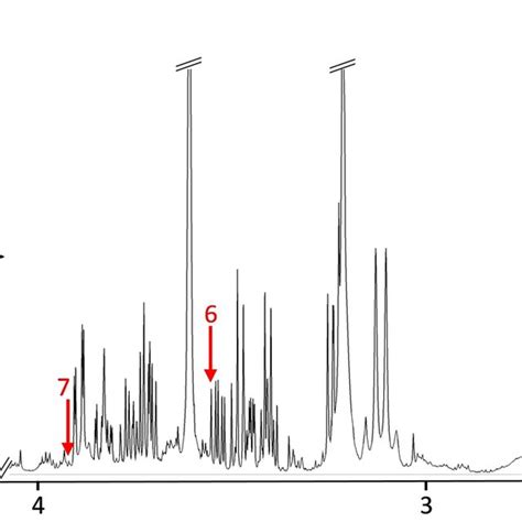 Representative 600 MHz ¹H NMR spectra of plasma showing the selected