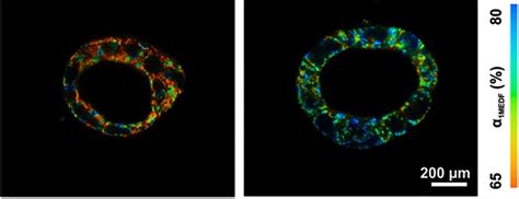 Evaluating Cell Metabolism Through Autofluorescence Imaging Of Nadph