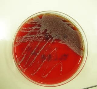 Hemolysis Types - Microbiology Lab Notes