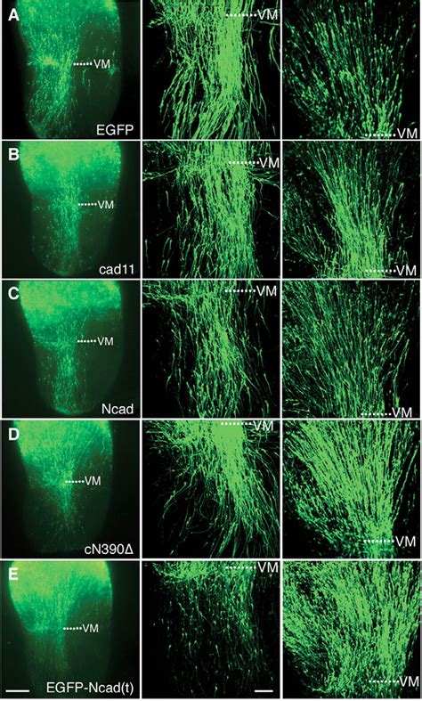 Figure 1 From Classic Cadherins Regulate Tangential Migration Of