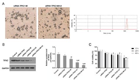 Identification Of Microvesicles And The Expression Level Of Tpx2 And