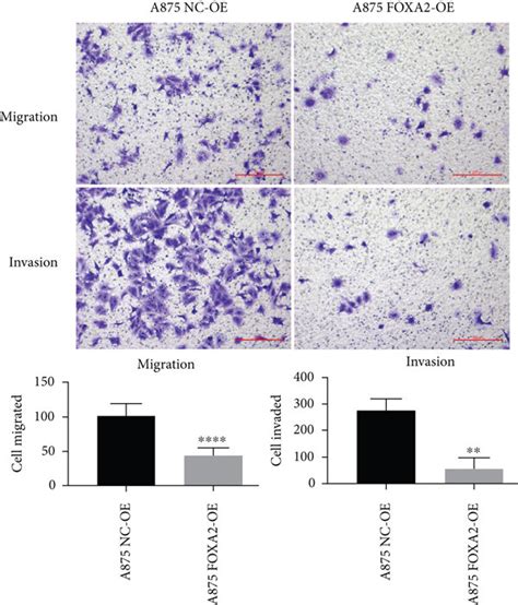 Foxa Inhibits Melanoma Cell Migration And Invasion In Vitro A B