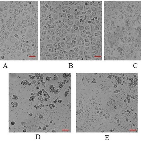 Mcf Cell Line On A Dmem Medium Treatment With B Dmso C