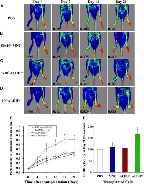 Transplantation Of BM Derived ALDH Hi Cells Improved Perfusion And