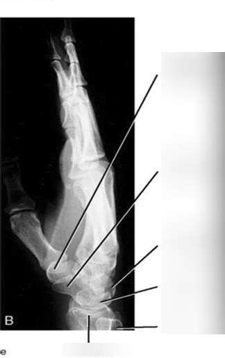 Med Imaging Msk Xray Hand Lateral Diagram Quizlet