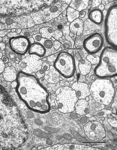 Chapter 2 Dendrites Fine Structure Of The Aging Brain Boston