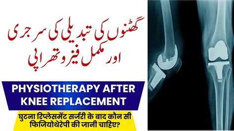 Ghutne Ke Operation Ke Baad Ki Exercise Knee Replacement