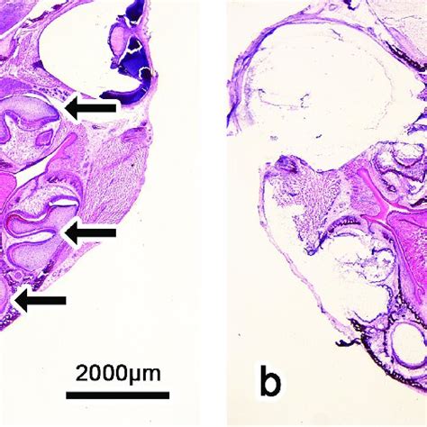 Histology Of P3 Rat Mandible And Maxilla Stained With Hematoxylin And
