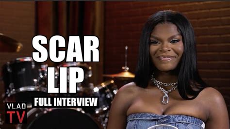 Scar Lip Full Interview Youtube