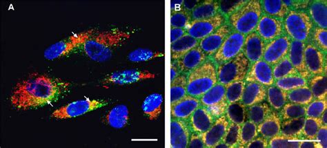 Humanin Colocalized With Mitochondria In Rpe Cells Primary Cultured