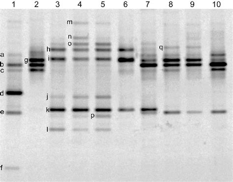 Table 1 From Culture Independent Bacterial Community Analysis Of The