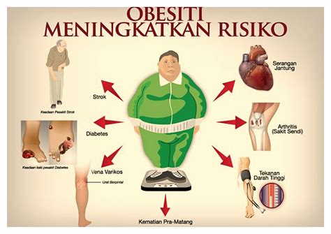 Begini Pengertian Obesitas,Cara Mencegah Dan Mengatasinya | Resiko Obesitas
