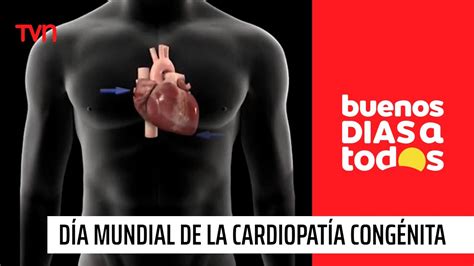 Hoy Es El D A Mundial De La Cardiopat A Cong Nita Buenos D As A Todos