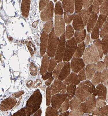 Muscle Phosphofructokinase/PFKM/PFK-1 Antibody (NBP1-87293): Novus ...