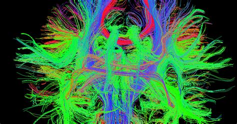 Diffusion Tensor Imaging Diffusion Imaging Introduction