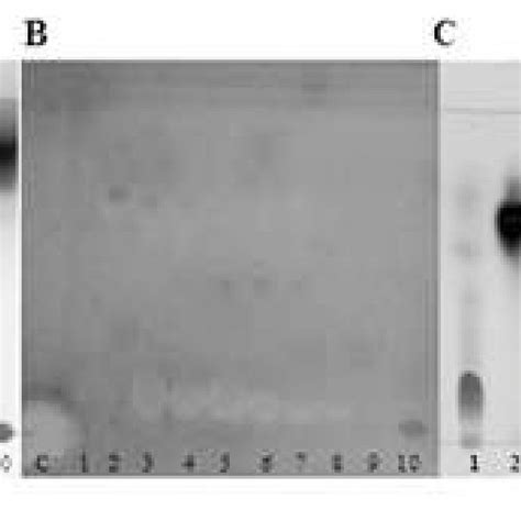 Tlc Bioautography One Set Was Visualized By Vanillin Sulphuric Acid