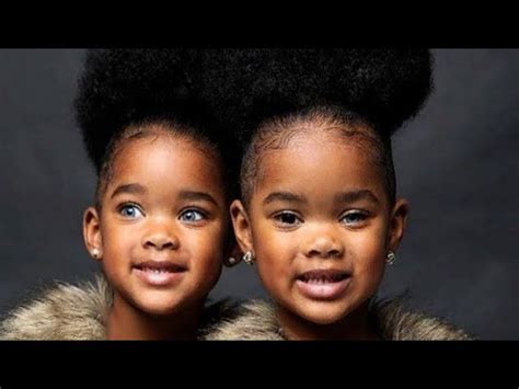 Identical Twins With Different Hair Color