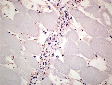 Bacillary Hemoglobinuria Veterian Key