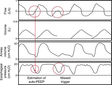 Ventilator Graphics Made Easy