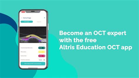 How To Interpret OCT Scans With Altris Education OCT App YouTube